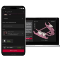 SprintRay NanoPrint - Software conectado e monitorização das impressões