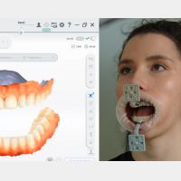 MetiSmile-MR rastreadores e marcadores